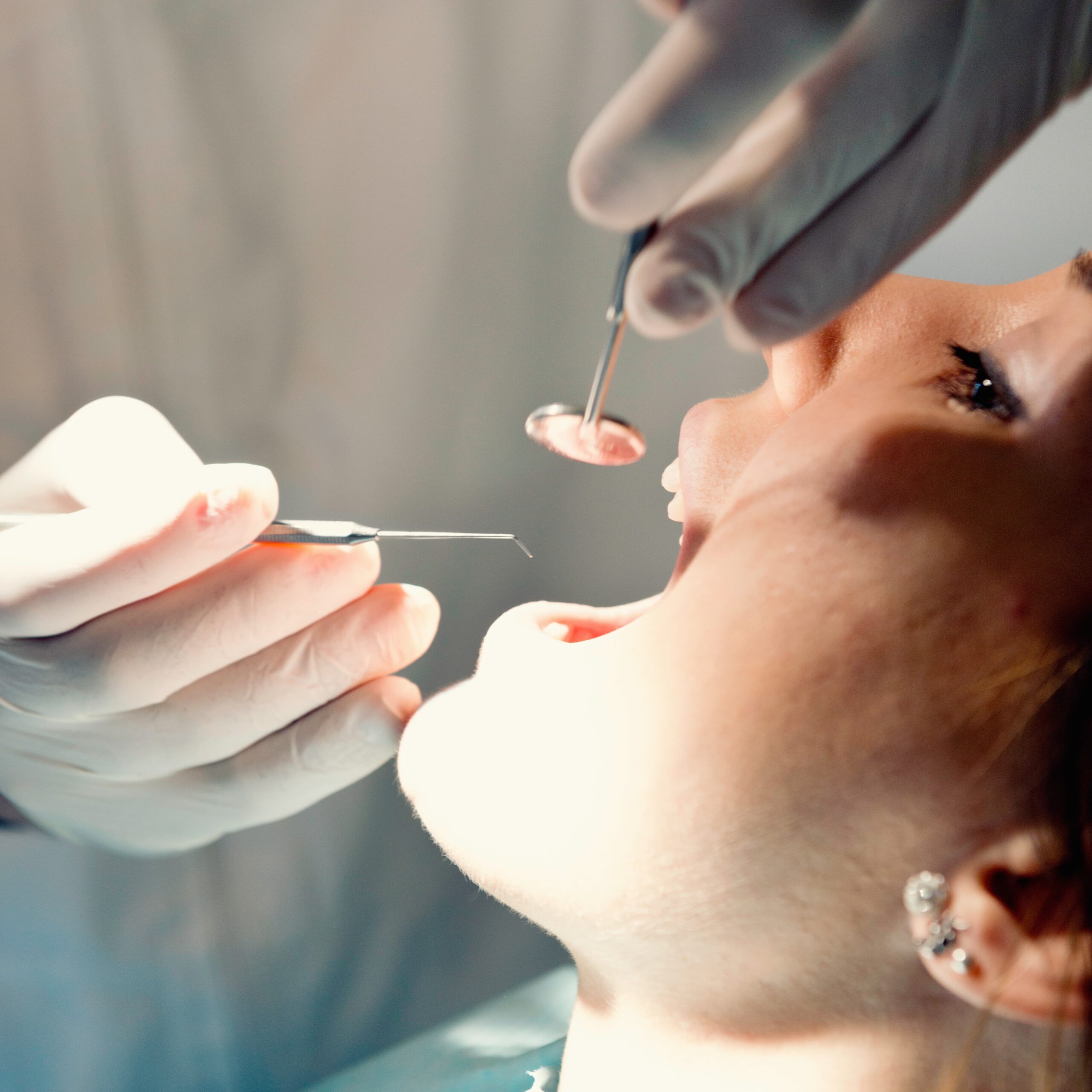 exploracion dental, bruxismo